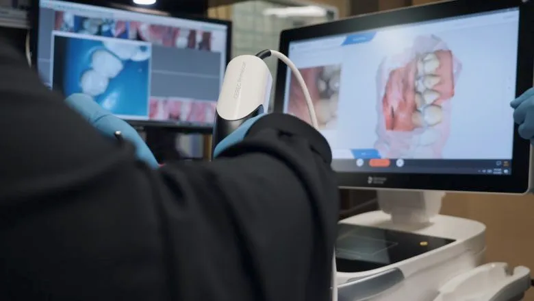 Preparation for CEREC