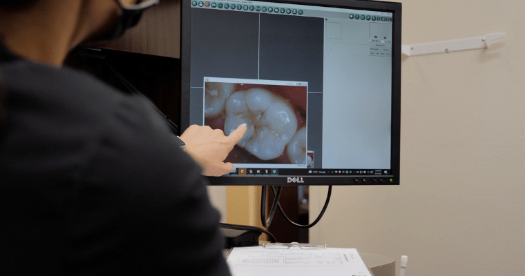 Doctor reading and identifying the dental scan of tooth. 