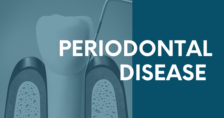 The initial stage of treatment for periodontal disease is usually a thorough cleaning that may include scaling or root planing.
