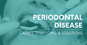 Periodontal Disease: Unlocking Causes, Symptoms, and Solutions