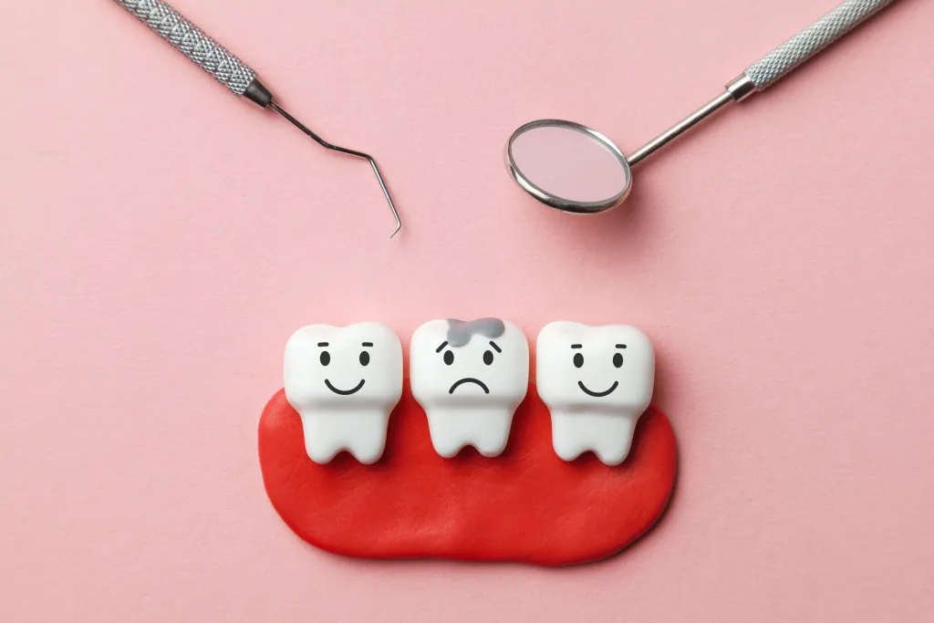 two teeth with mercury free filling middle tooth with amalgam filling