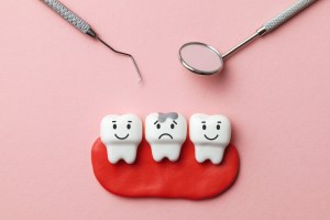 two teeth with mercury free filling middle tooth with amalgam filling
